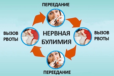 Лечение булимии в Иланском